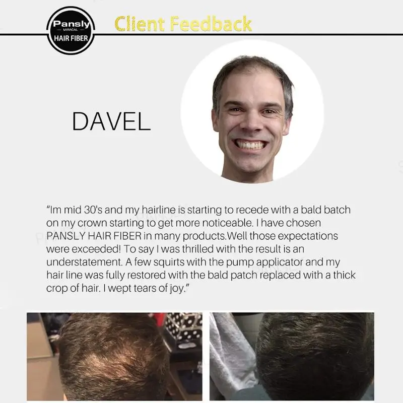 27.5g Men Women Hair Building Fibers Instant Thickening Powder for thinning Hair Loss Concealing Fillers Spray Back Cover
27.5g Men Women Hair Building Fibers Instant Thickening Powder for thinning Hair Loss Concealing Fillers Spray Back Cover