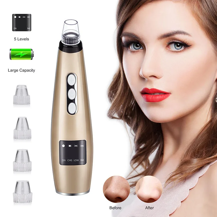 Пять Шестерни Blackhead всасывающий инструмент для очистки и ухода за ногами Черноголовых инструмент для удаления угрей акне смазка клещей
Пять Шестерни Blackhead всасывающий инструмент для очистки и ухода за ногами Черноголовых инструмент для удаления угрей акне смазка клещей