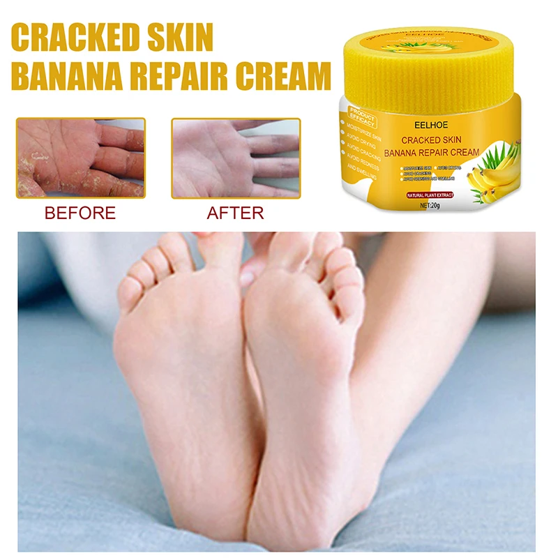 Natural Banana Oil Anti-Drying Crack Foot Cream Heel Cracked Repair Cream Removal Dead Skin Hand Feet Care 20g
Natural Banana Oil Anti-Drying Crack Foot Cream Heel Cracked Repair Cream Removal Dead Skin Hand Feet Care 20g