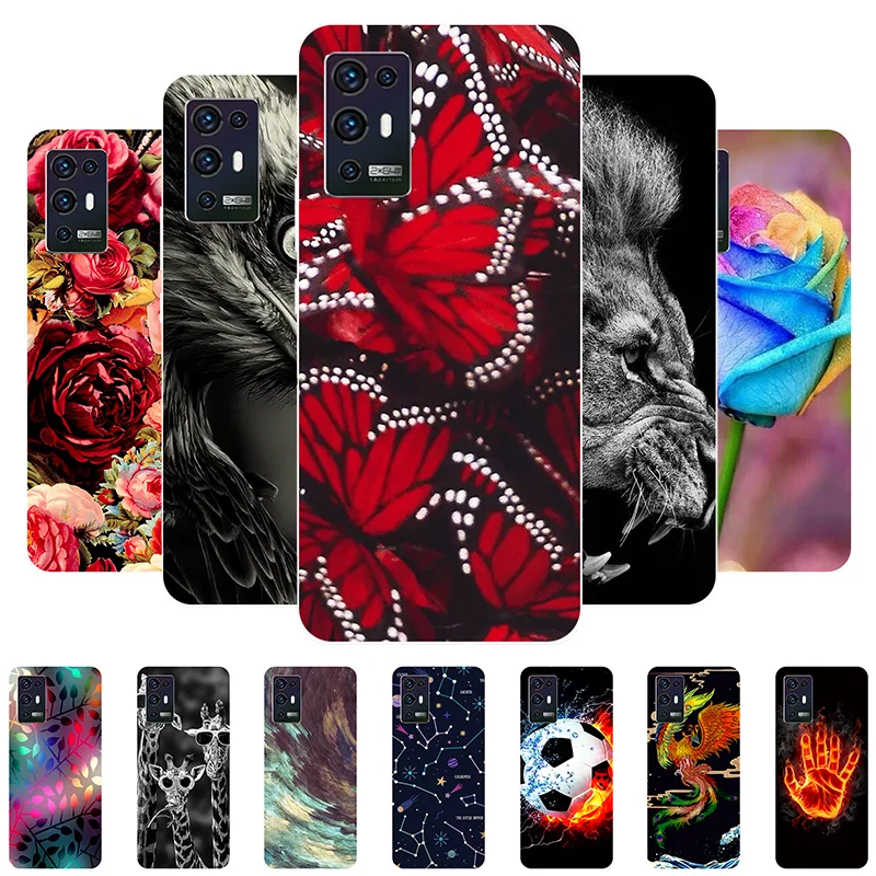 Phone Case For ZTE Axon 30 Pro Cover Soft Silicone Butterfly Fundas For ZTE Axon 30 5G Case Coque for ZTE Axon 30 Ultra 30Pro
Phone Case For ZTE Axon 30 Pro Cover Soft Silicone Butterfly Fundas For ZTE Axon 30 5G Case Coque for ZTE Axon 30 Ultra 30Pro
