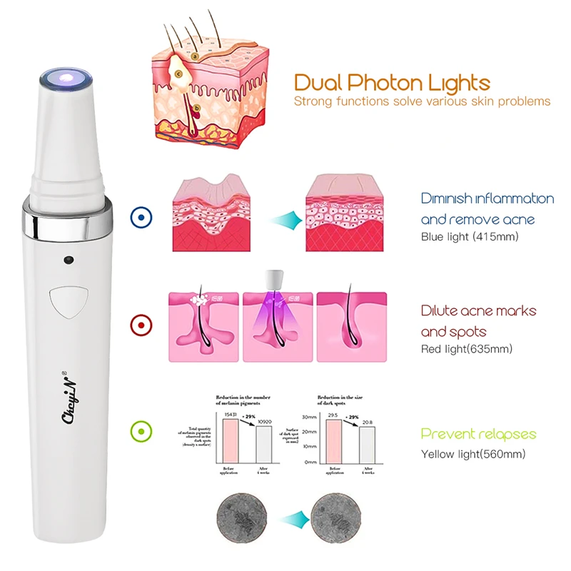 Acne Blue Light Photon Therapy Warm Treatment Beauty Massager Skin Whitening Skin Spots Removal Pen care Facial skin Firming
Acne Blue Light Photon Therapy Warm Treatment Beauty Massager Skin Whitening Skin Spots Removal Pen care Facial skin Firming