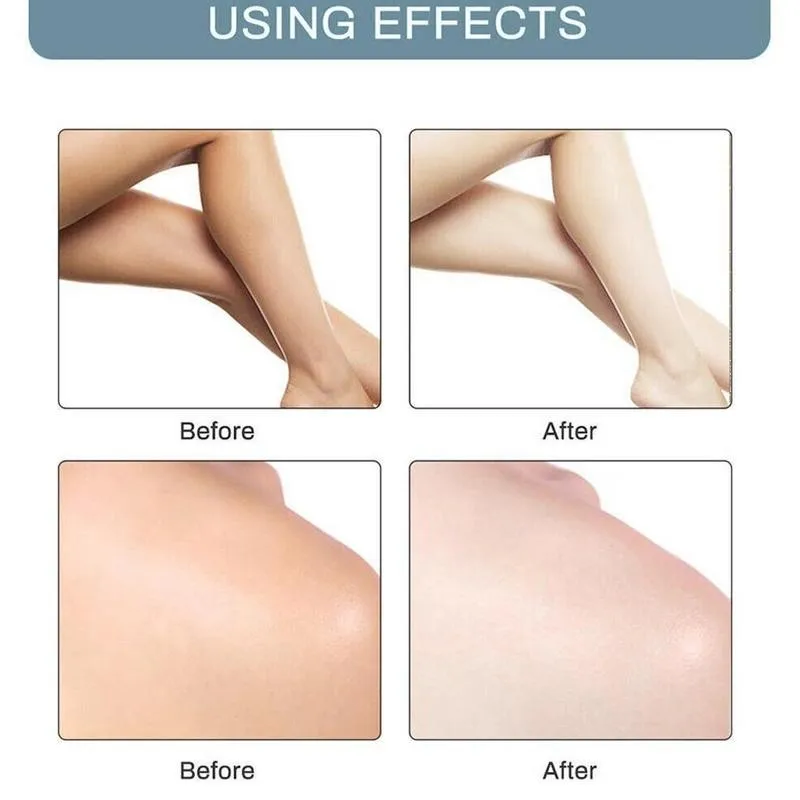 60ml Instant Whitening Cream Underarm Armpit Whitening Cream Knees For Women Cream Parts Body Legs Care Private Whitening S V3V0
60ml Instant Whitening Cream Underarm Armpit Whitening Cream Knees For Women Cream Parts Body Legs Care Private Whitening S V3V0
