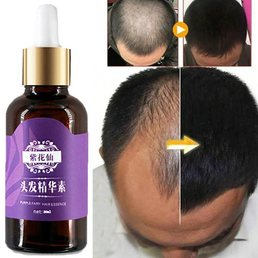 20ml Hair Loss Treatment Products Natural With No Side Hair Grow Growth Oil Hair Regrowth Effects Faster Essence Products R6J5
20ml Hair Loss Treatment Products Natural With No Side Hair Grow Growth Oil Hair Regrowth Effects Faster Essence Products R6J5