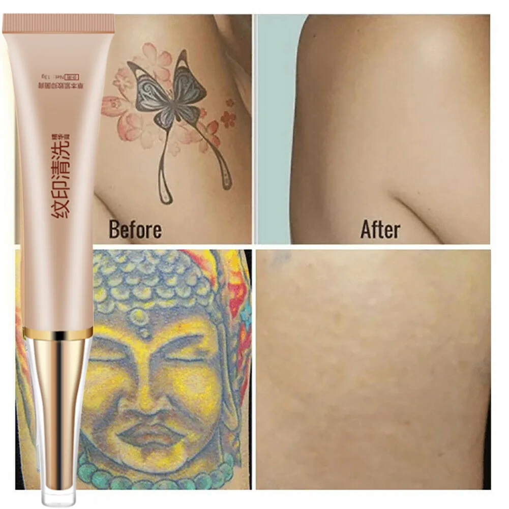 Permanent Tattoo Removal Cream No Need for Pain Removal Maximum Strength Natural ingredients Safe Non-Toxic Moisturize
Permanent Tattoo Removal Cream No Need for Pain Removal Maximum Strength Natural ingredients Safe Non-Toxic Moisturize