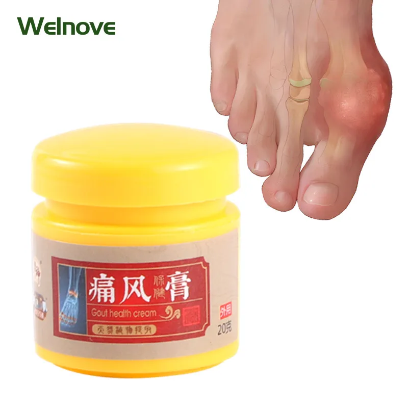 20g Gout Pain Relief Cream Joint Swelling Ache Foot Toes Finger Pain Arthritis Bone Massage Herbal Medical Plaster Health Care
20g Gout Pain Relief Cream Joint Swelling Ache Foot Toes Finger Pain Arthritis Bone Massage Herbal Medical Plaster Health Care