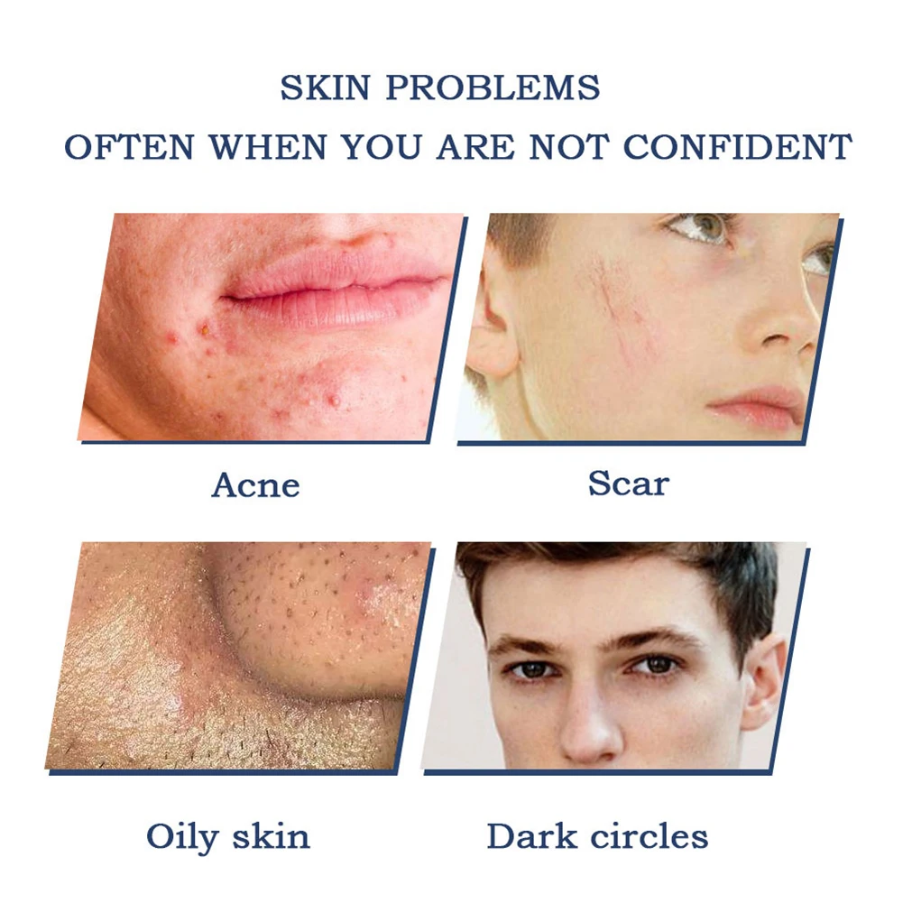 Men's Makeup Concealer BB Cream Nature Color Whitening Liquid Concealer Brighten Makeup HJL2019
Men's Makeup Concealer BB Cream Nature Color Whitening Liquid Concealer Brighten Makeup HJL2019
