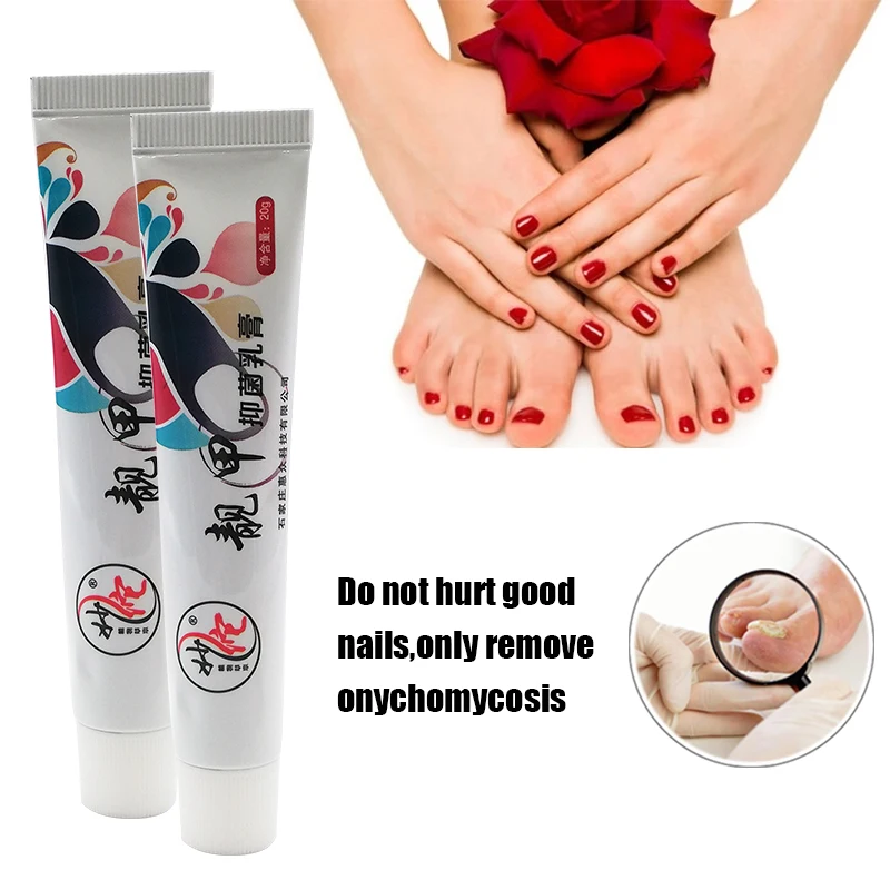 Nail Treatment Ointment+Nail File Treat Onychomycosis Paronychia Anti FungalInfection Grinding Polishing Manicure Care Tool
Nail Treatment Ointment+Nail File Treat Onychomycosis Paronychia Anti FungalInfection Grinding Polishing Manicure Care Tool