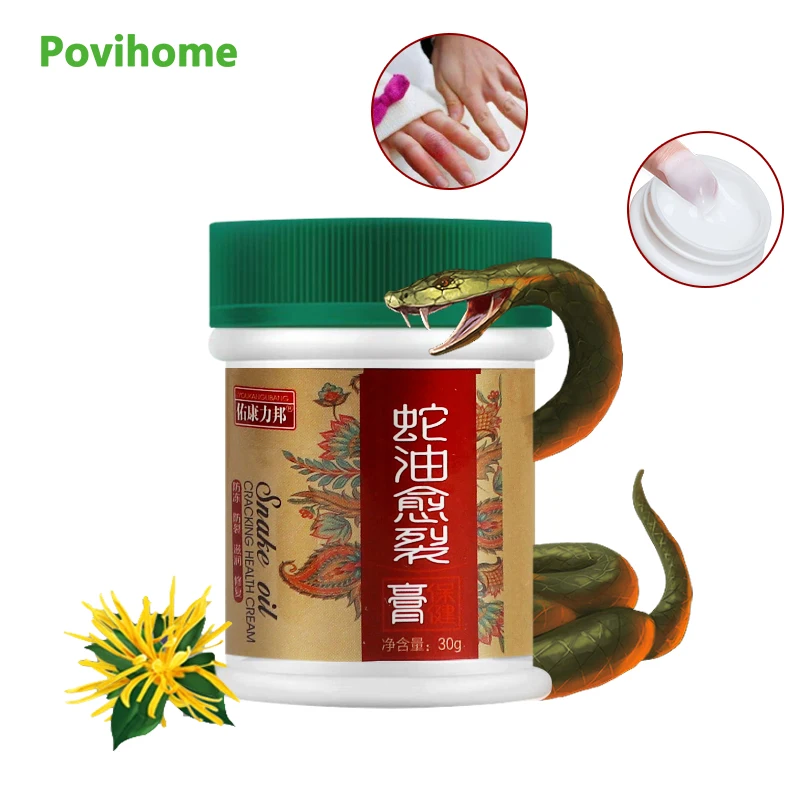 Moisturizing Snake Oil Anti Crack Cream Anti Peeling Moisture Foot Ointment Heel Chapped Remove Dead Skin Plaster Health Care
Moisturizing Snake Oil Anti Crack Cream Anti Peeling Moisture Foot Ointment Heel Chapped Remove Dead Skin Plaster Health Care