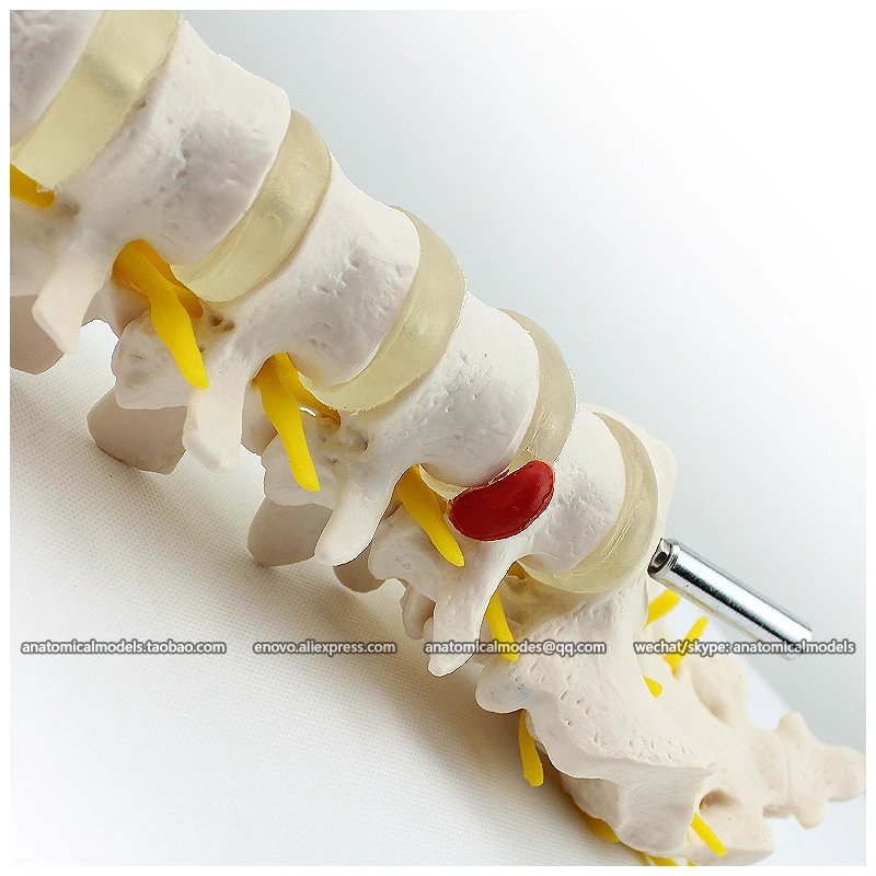 12384 / Human Lumbar Vertebrae w/ Sacrum & Coccyx Anatomy Model, Medical Science Teaching Anatomical Models
12384 / Human Lumbar Vertebrae w/ Sacrum & Coccyx Anatomy Model, Medical Science Teaching Anatomical Models