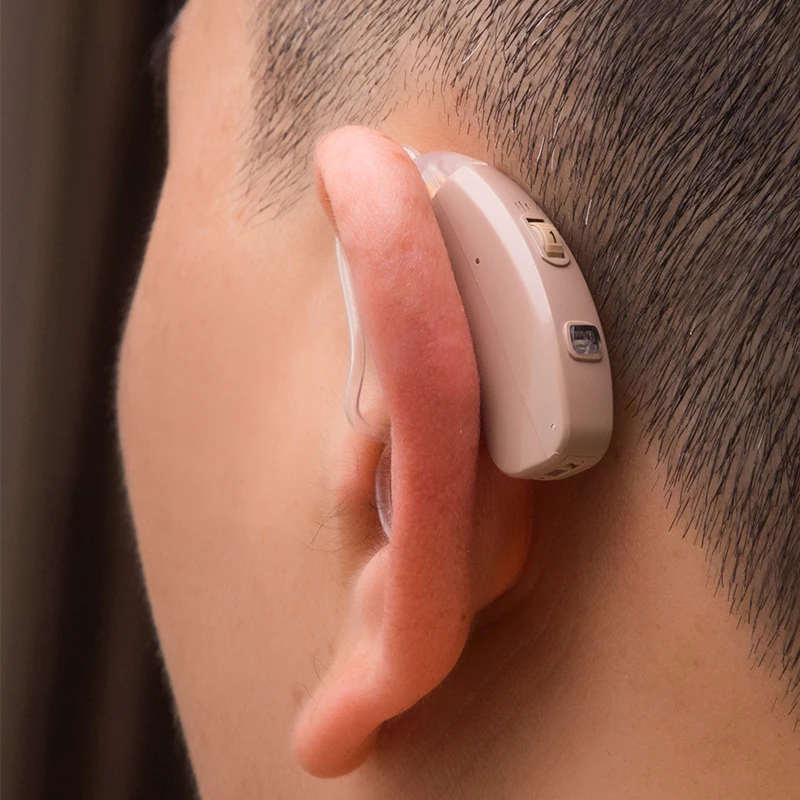 MY-201s Professional Hearing Aid Rechargeable Full Digital Hearing Aids 2 Channels Hearing Amplifier Hearing Device for Deafnes
MY-201s Professional Hearing Aid Rechargeable Full Digital Hearing Aids 2 Channels Hearing Amplifier Hearing Device for Deafnes
