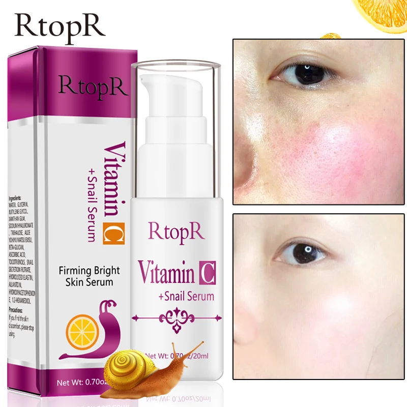 Snail Vitamin C Serum Hyaluronic Acid Anti-Aging Shrink Pore Whitening Moisturizing Essence Oil Control Face Serum Skin Care 20g
Snail Vitamin C Serum Hyaluronic Acid Anti-Aging Shrink Pore Whitening Moisturizing Essence Oil Control Face Serum Skin Care 20g
