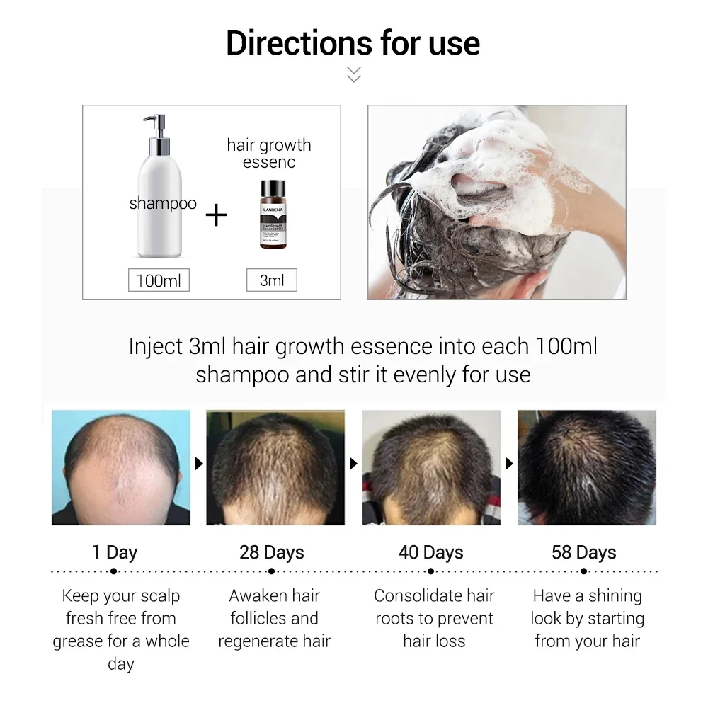 LANBENA Hair Growth Essence Hair Growth Products Essential Oil Liquid Treatment Preventing Hair Loss Hair Care Andrea 20ml 2PCS
LANBENA Hair Growth Essence Hair Growth Products Essential Oil Liquid Treatment Preventing Hair Loss Hair Care Andrea 20ml 2PCS