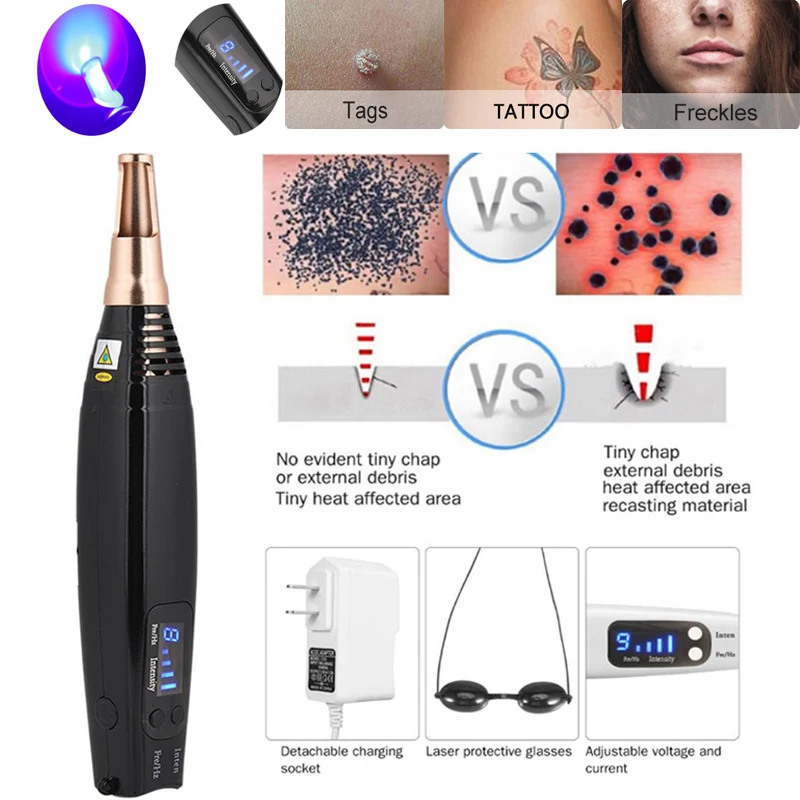 

Picosecond Laser Pen Blue&red Remove Tattoo Laser Pen Freckle Acne Scar Mole Dark Spot Pigment Tattoo Remove Machine Beauty Tool