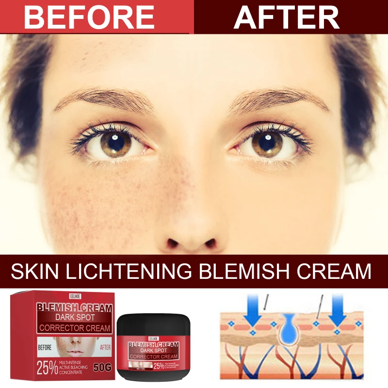 Face Cream Effective Whitening Remove Dark Spots Facial Cream Repair Fade Freckls Melanin Remover Brighten Moisturizing TSLM1
Face Cream Effective Whitening Remove Dark Spots Facial Cream Repair Fade Freckls Melanin Remover Brighten Moisturizing TSLM1