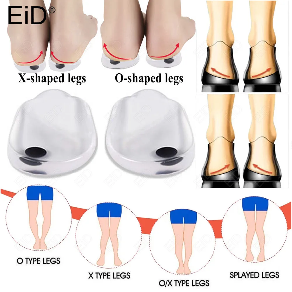 EiD Silicone Gel Varus Orthotic Insole X/O Legs Correction Orthopedic Shoes Pad Plantar Fasciitis Arch Support Flat Foot Care
EiD Silicone Gel Varus Orthotic Insole X/O Legs Correction Orthopedic Shoes Pad Plantar Fasciitis Arch Support Flat Foot Care