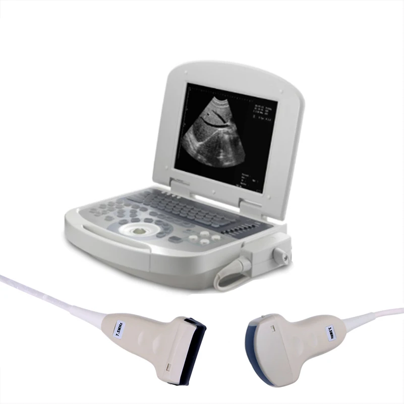 Portable Veterinary Full Digital Ultrasound Machine Price Vet Portable Digital 10.4 Inches Ultrasound Machine
Portable Veterinary Full Digital Ultrasound Machine Price Vet Portable Digital 10.4 Inches Ultrasound Machine