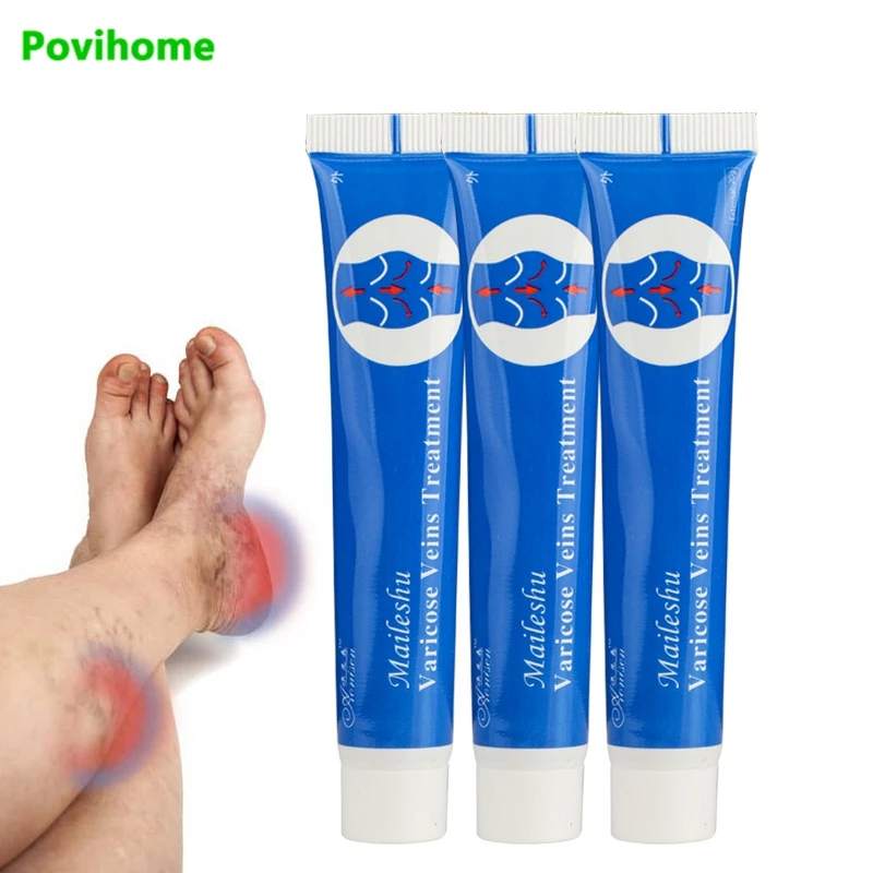 25g Varicose Veins Treatment Gel Varicosity Angiitis Removal Phlebitis legs Veins Ointment Relief Veins Pain Chinese Herbals
25g Varicose Veins Treatment Gel Varicosity Angiitis Removal Phlebitis legs Veins Ointment Relief Veins Pain Chinese Herbals