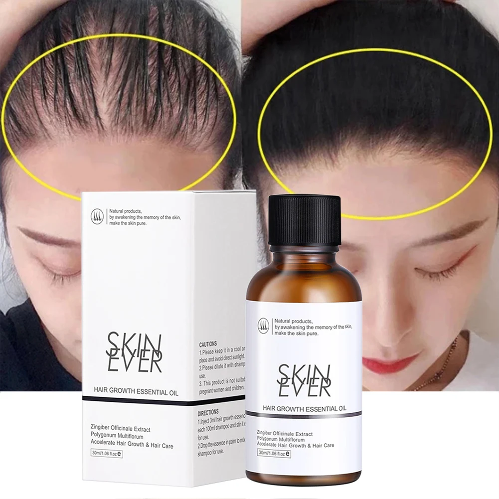 Hair Growth Serum Hair Loss Preventation Repair Hair Follicles and Promote Hair Growth Hair Care Essence Oil Nourish the scalp
Hair Growth Serum Hair Loss Preventation Repair Hair Follicles and Promote Hair Growth Hair Care Essence Oil Nourish the scalp
