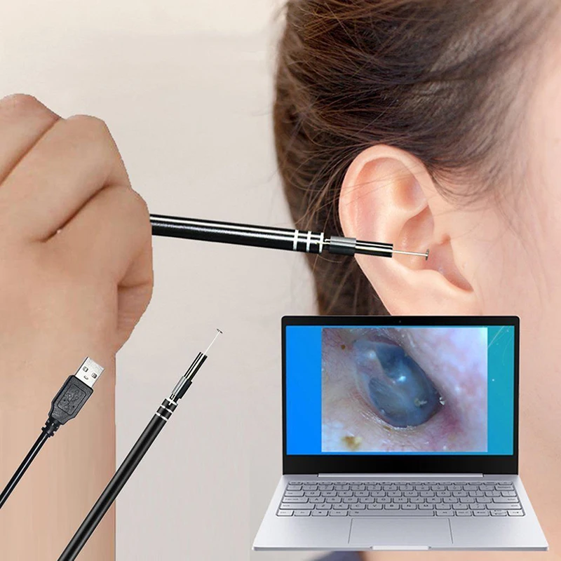 Visual Ear Cleaning Tool Mini Camera Otoscope Ear Health Care USB Ear Cleaning Endoscope For Windows PC Phones
Visual Ear Cleaning Tool Mini Camera Otoscope Ear Health Care USB Ear Cleaning Endoscope For Windows PC Phones