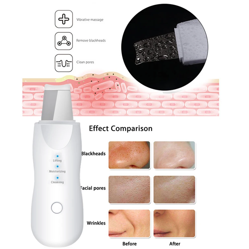 RF EMS LED Photon Skin Rejuvenation Radio Mesotherapy Facial Lifting+Skin Scrubber Blackhead Remover + Facial steamer Nano spray
RF EMS LED Photon Skin Rejuvenation Radio Mesotherapy Facial Lifting+Skin Scrubber Blackhead Remover + Facial steamer Nano spray