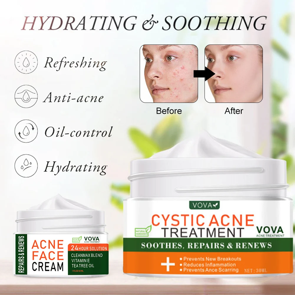 Vova Acne Cream Light Acne Mark Moisturizing Acne Cream Facial Skin Repair Cream Acne Pimples Skin Treatment Cream
Vova Acne Cream Light Acne Mark Moisturizing Acne Cream Facial Skin Repair Cream Acne Pimples Skin Treatment Cream