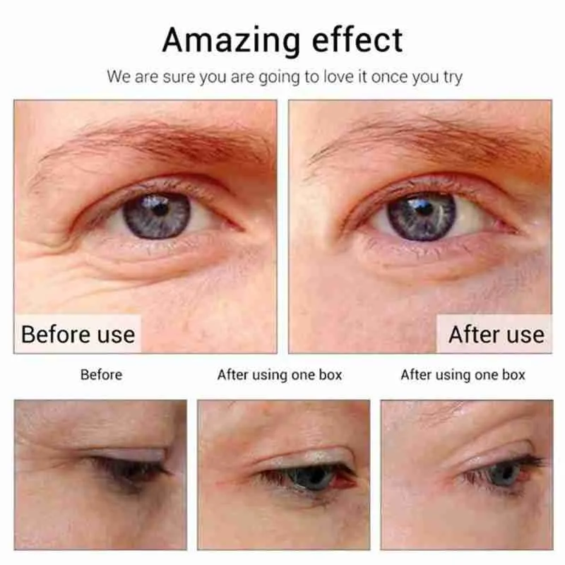

Seaweed Collagen Eye Mask Remove Dark Circles Eye Bag Anti Age Aging Moisturizing Hyaluronic Acid Serum Patches 60pcs