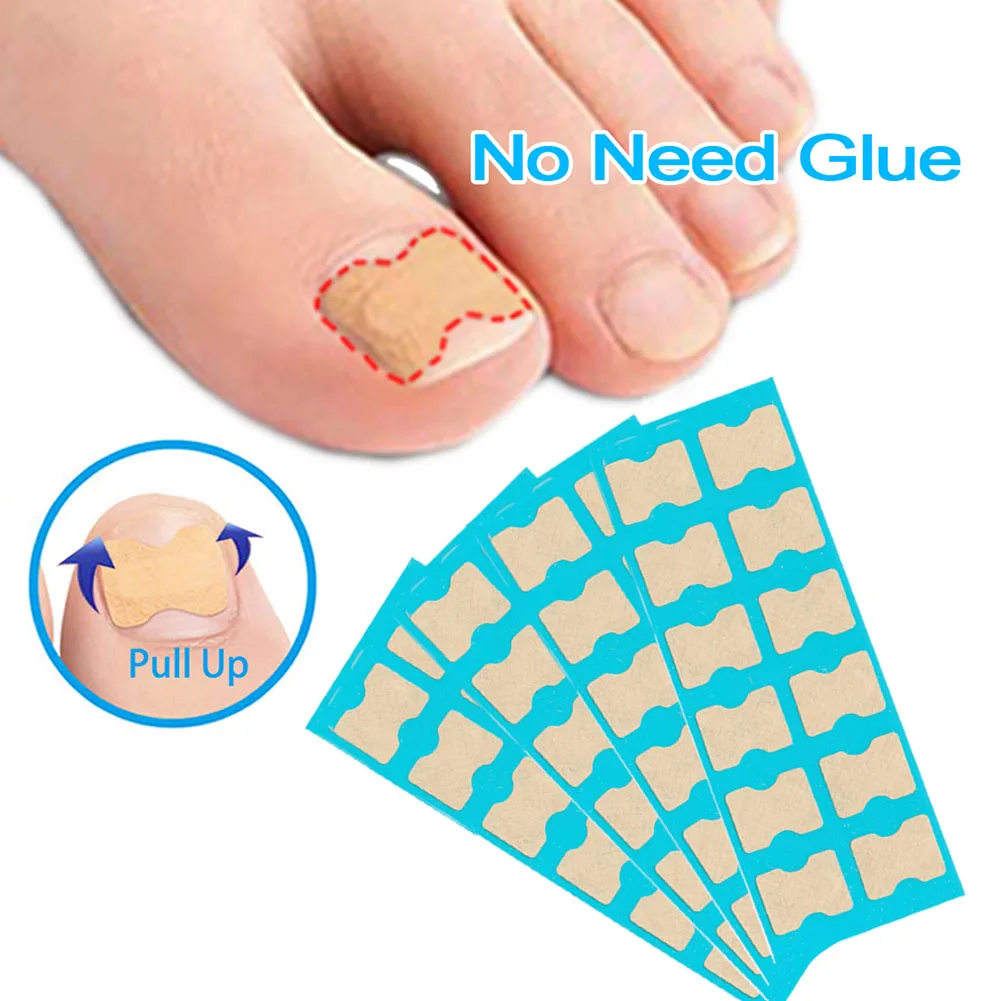 4Pcs Ingrown Toenail Correction Sticker Professional Adhesive Ingrown Toenails Correction Patch Foot Care Tape for Men Women
4Pcs Ingrown Toenail Correction Sticker Professional Adhesive Ingrown Toenails Correction Patch Foot Care Tape for Men Women