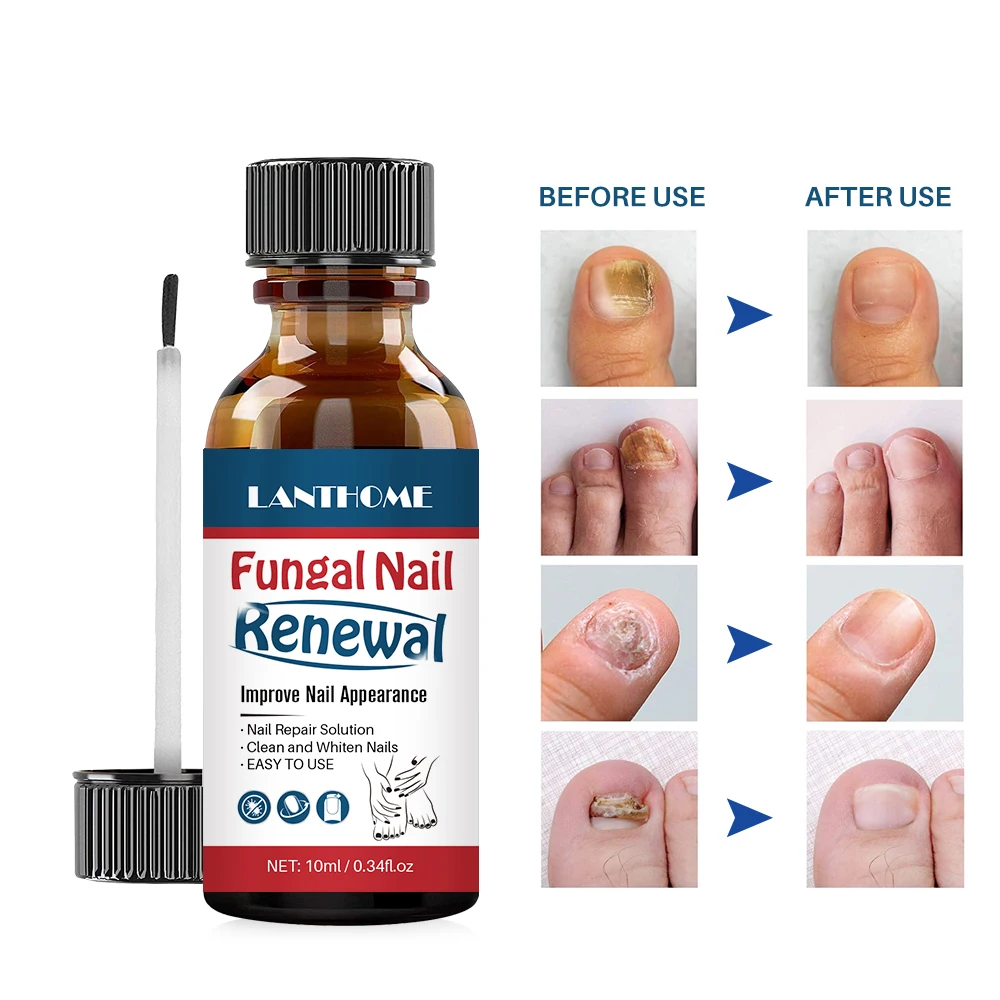 natural nail strengthener growth cuticle oil Nail Liquid Repair Treatment Nail Toe Fungus Removal Moisturizing Nail Foot Care
natural nail strengthener growth cuticle oil Nail Liquid Repair Treatment Nail Toe Fungus Removal Moisturizing Nail Foot Care