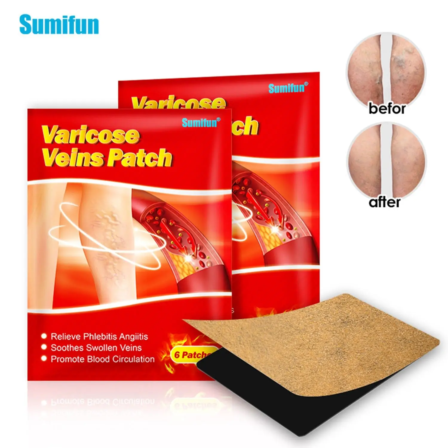 Blood Vessel Rotten Legs Varicose Phlebitis Varicose Veins Patches Ointment Health Care Vasculitis Cream Treatment
Blood Vessel Rotten Legs Varicose Phlebitis Varicose Veins Patches Ointment Health Care Vasculitis Cream Treatment