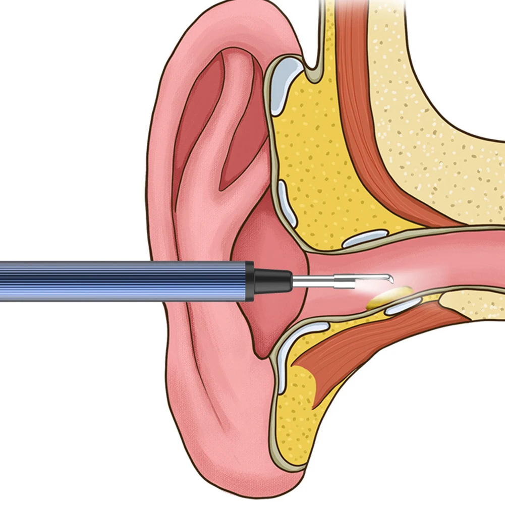 Smart Camera Borescope Visual Ear Pick Wireless WIFI Link APP APP Ear Cleaner Ear Wax Removal Tool Ear Cleaner
Smart Camera Borescope Visual Ear Pick Wireless WIFI Link APP APP Ear Cleaner Ear Wax Removal Tool Ear Cleaner