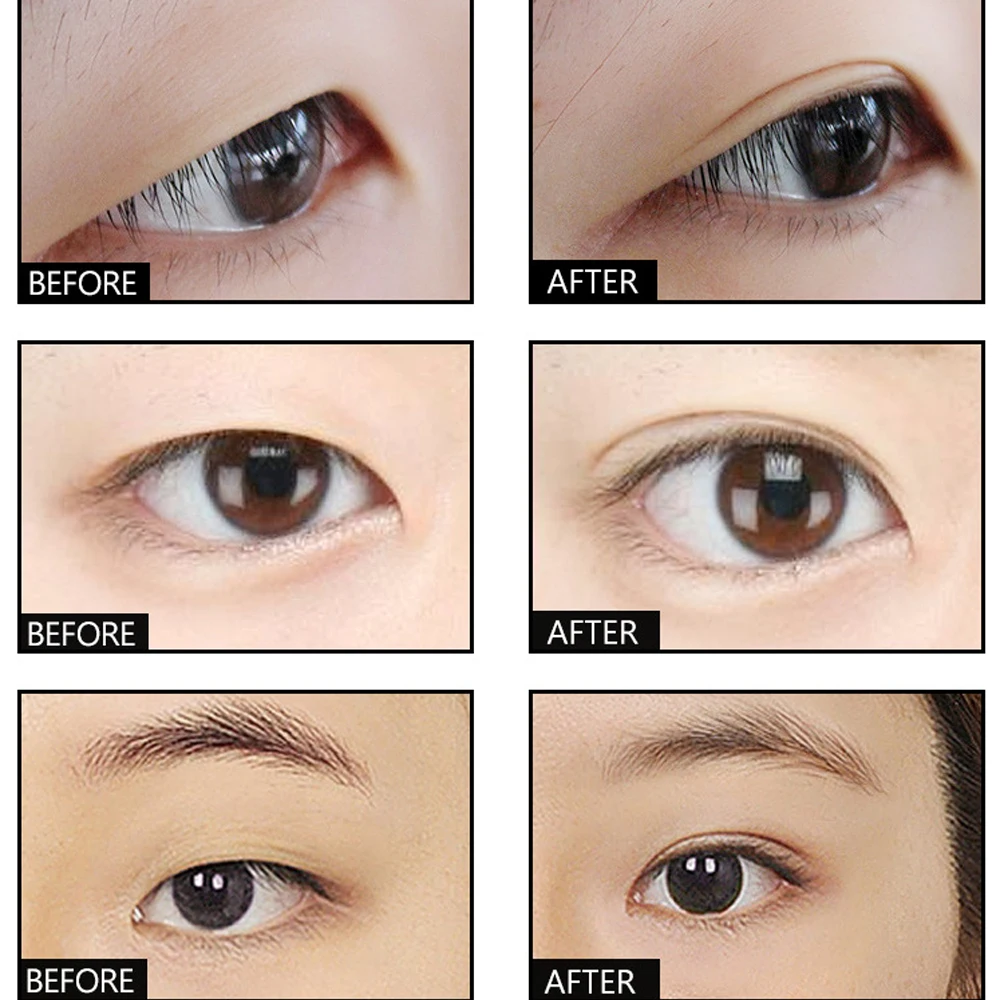 Professional Invisible Double Eyelids Big Eye Not Glue Transparent Eyelid Super Stretch Fold Lift Eyes Styling Strong Adhesive
Professional Invisible Double Eyelids Big Eye Not Glue Transparent Eyelid Super Stretch Fold Lift Eyes Styling Strong Adhesive