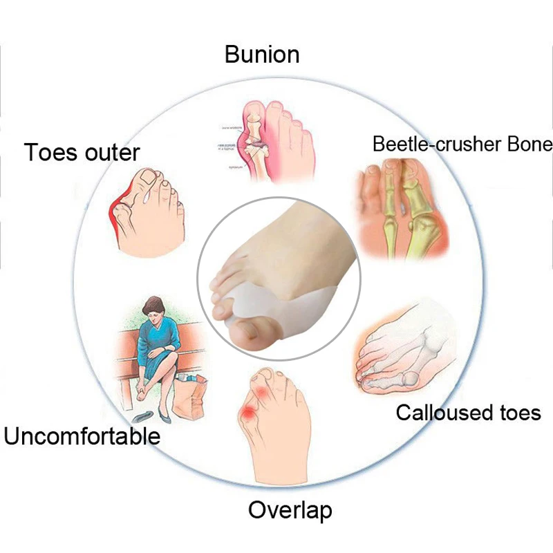 2Pcs Silicone Toes Separator Bunion Bone Ectropion Adjuster Toes Outer Appliance Foot Care Tools Hallux Valgus Corrector Insoles
2Pcs Silicone Toes Separator Bunion Bone Ectropion Adjuster Toes Outer Appliance Foot Care Tools Hallux Valgus Corrector Insoles
