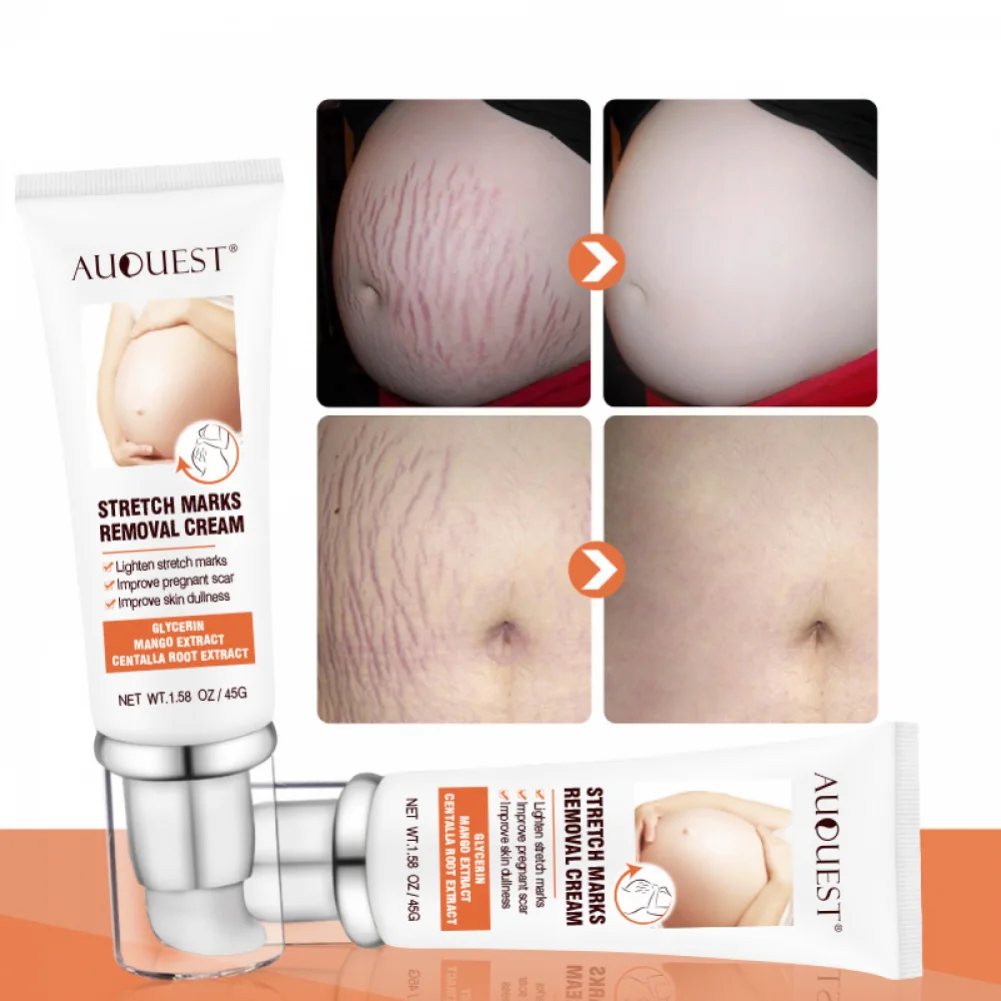 Removes Stretch Marks Fade Scars Obesity Marks Pregnant Women Postpartum Repair Cream Repair Cream Anti-Winkles Body Cream
Removes Stretch Marks Fade Scars Obesity Marks Pregnant Women Postpartum Repair Cream Repair Cream Anti-Winkles Body Cream