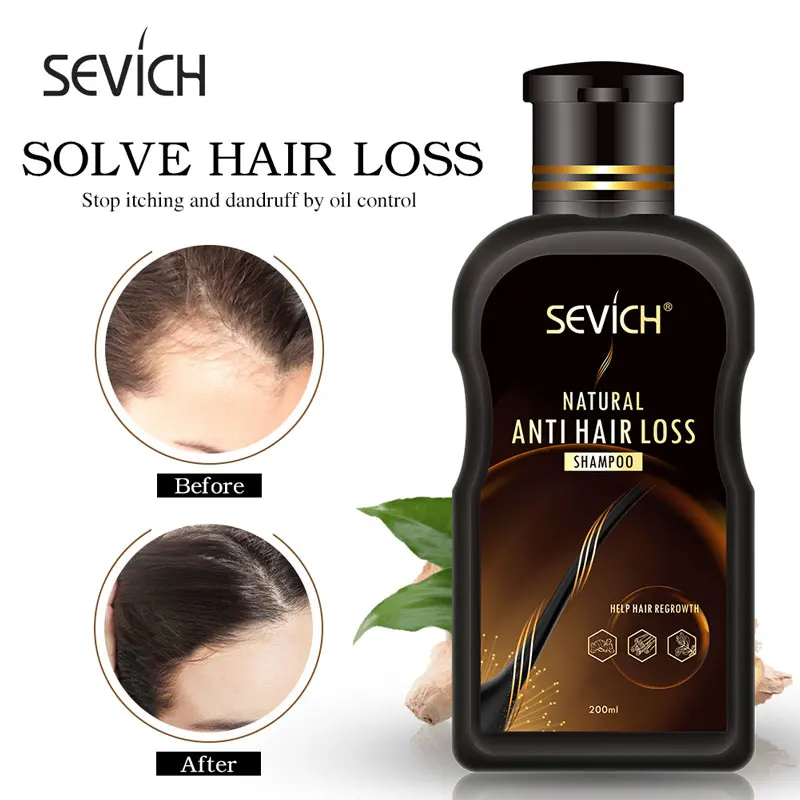 Sevich 200ml Anti Hair Loss Product Hair Loss Shampoo Natural With No Side Effects Grow Hair Faster Regrowth Hair Treatment
Sevich 200ml Anti Hair Loss Product Hair Loss Shampoo Natural With No Side Effects Grow Hair Faster Regrowth Hair Treatment