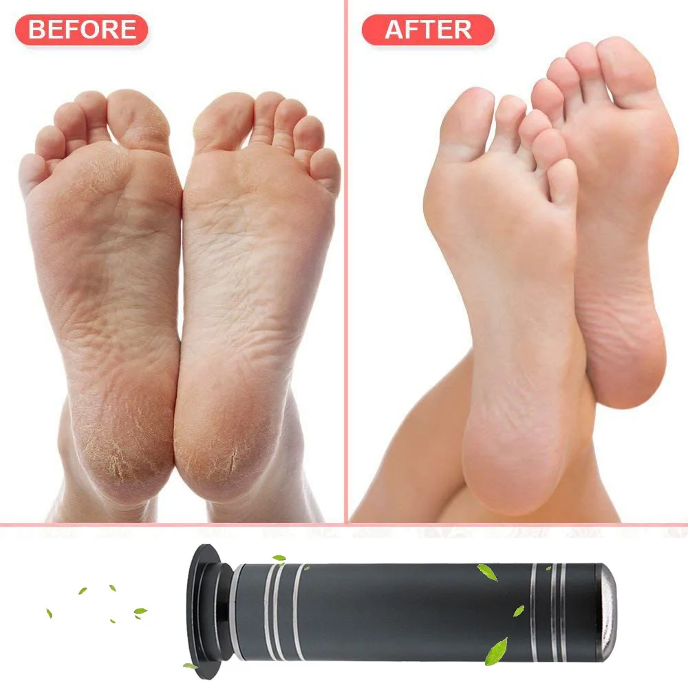 Electric Callus Remover Foot Grinder Automatic Pedicure Machine Foot File Care Tool Remove The Callus Professional Kit Feet Care
Electric Callus Remover Foot Grinder Automatic Pedicure Machine Foot File Care Tool Remove The Callus Professional Kit Feet Care
