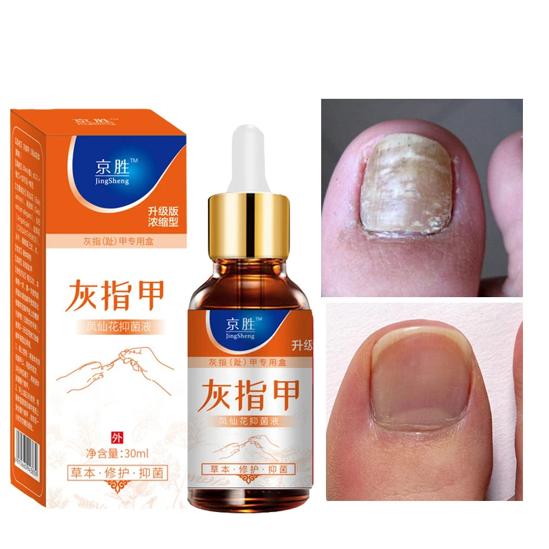 Nail care essence, nail polish, effective moisturizing, anti-fungal removal, foot care solution, repair cream, nail care
Nail care essence, nail polish, effective moisturizing, anti-fungal removal, foot care solution, repair cream, nail care
