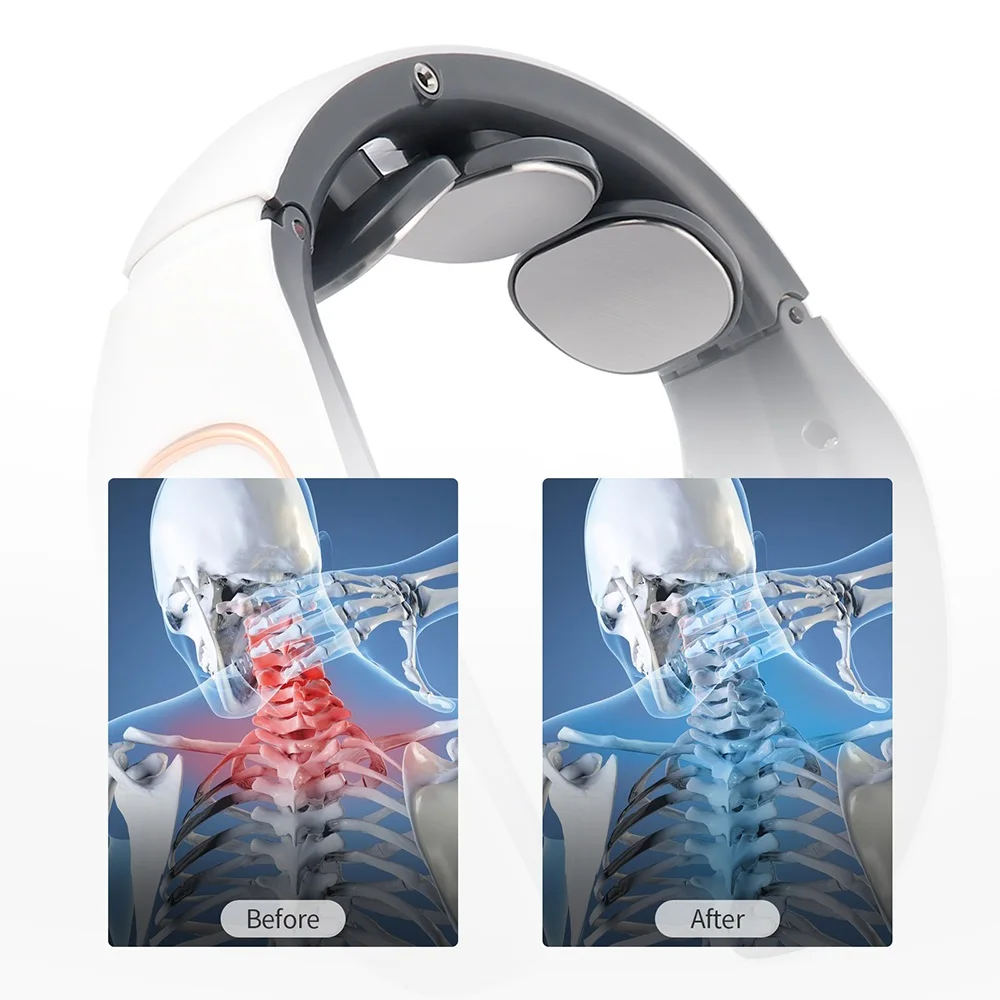 Smart Electric Pulse Neck Massager Far Infrared Heating Neck Shoulder Massage 4D TENS Pulse Cervical Pain Relief Relax Tool
Smart Electric Pulse Neck Massager Far Infrared Heating Neck Shoulder Massage 4D TENS Pulse Cervical Pain Relief Relax Tool