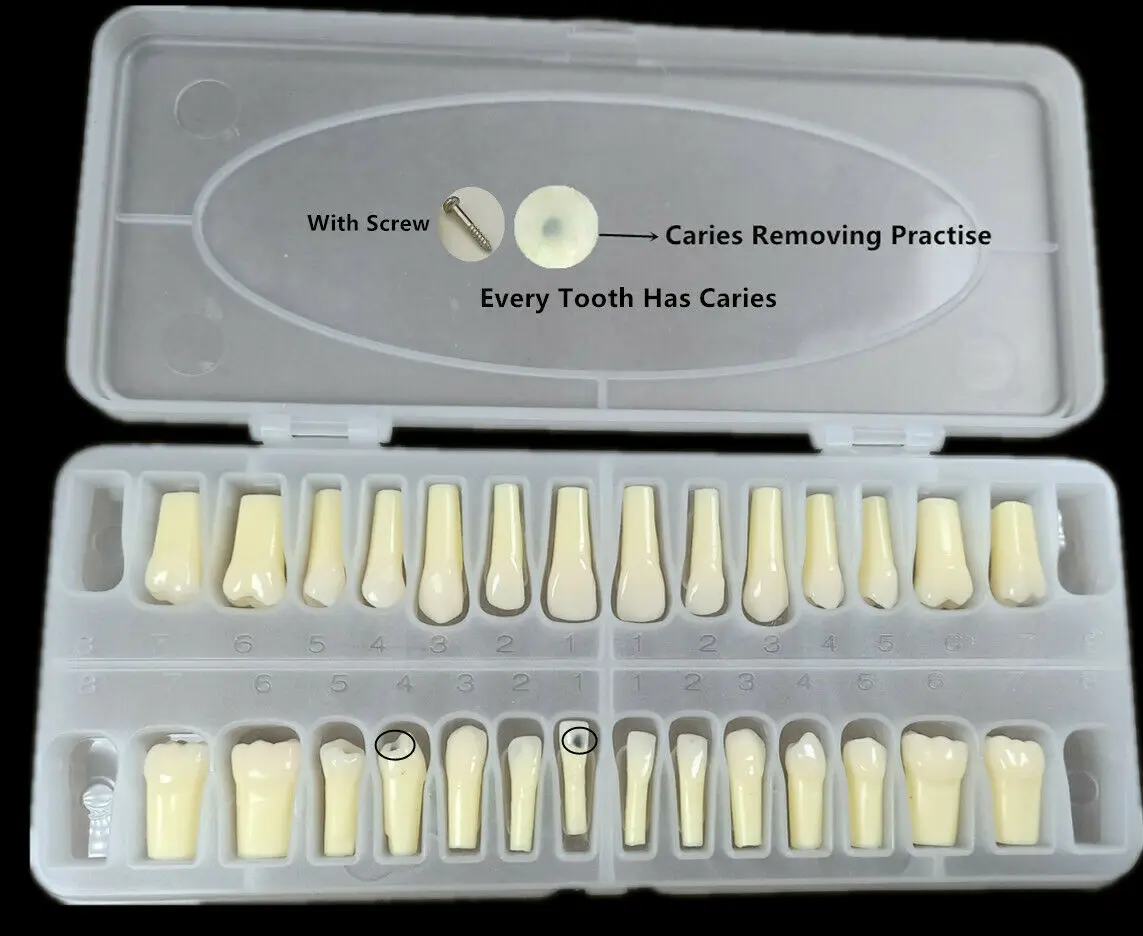1Box=28pcs Dental Screw Caries Remove Decayed Teeth Practise Cuspid Student Teaching Model
1Box=28pcs Dental Screw Caries Remove Decayed Teeth Practise Cuspid Student Teaching Model