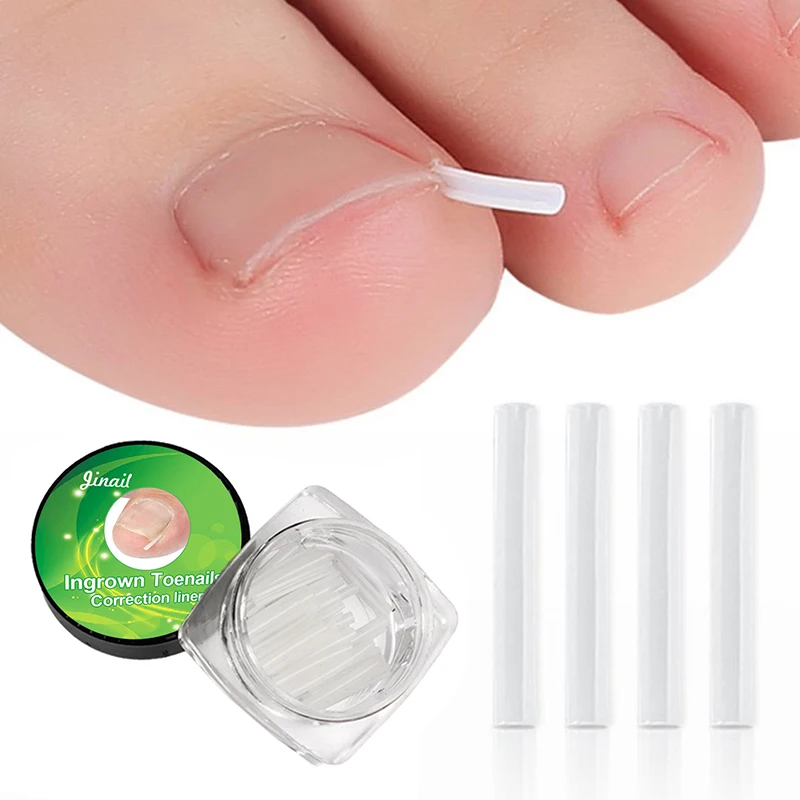 10 Piece Ingrown Pads Nail Groove Orthopedic Pads Nail Correction Devices Correction Treatments Sticker Patch Foot Care Tools
10 Piece Ingrown Pads Nail Groove Orthopedic Pads Nail Correction Devices Correction Treatments Sticker Patch Foot Care Tools