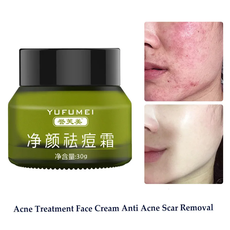 Acne Treatment Face Cream Anti Acne Scar Removal Pimple Blackhead Moisturizing Whiten Oil-control Shrink Pores Skin Care
Acne Treatment Face Cream Anti Acne Scar Removal Pimple Blackhead Moisturizing Whiten Oil-control Shrink Pores Skin Care