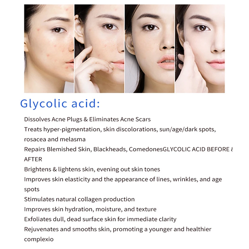 Glycolic Acid 60% 5ml aha glycolic peeling acid beauty salon remove acne pockmark peeling treatment dermabra-sion
Glycolic Acid 60% 5ml aha glycolic peeling acid beauty salon remove acne pockmark peeling treatment dermabra-sion