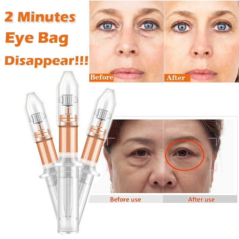 2 Minutes Instantly Eye Bag Removal Cream Long Lasting Effect Puffiness Wrinkles Fine Lines Remove Eye Cream Eyes Care
2 Minutes Instantly Eye Bag Removal Cream Long Lasting Effect Puffiness Wrinkles Fine Lines Remove Eye Cream Eyes Care