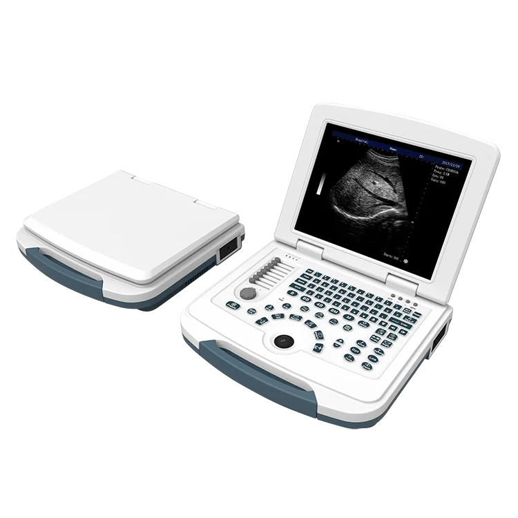 Hot sale Competitive Price of Laptop Ultrasound Machine Cheap B/W Ultrasound Scanner DW-580
Hot sale Competitive Price of Laptop Ultrasound Machine Cheap B/W Ultrasound Scanner DW-580