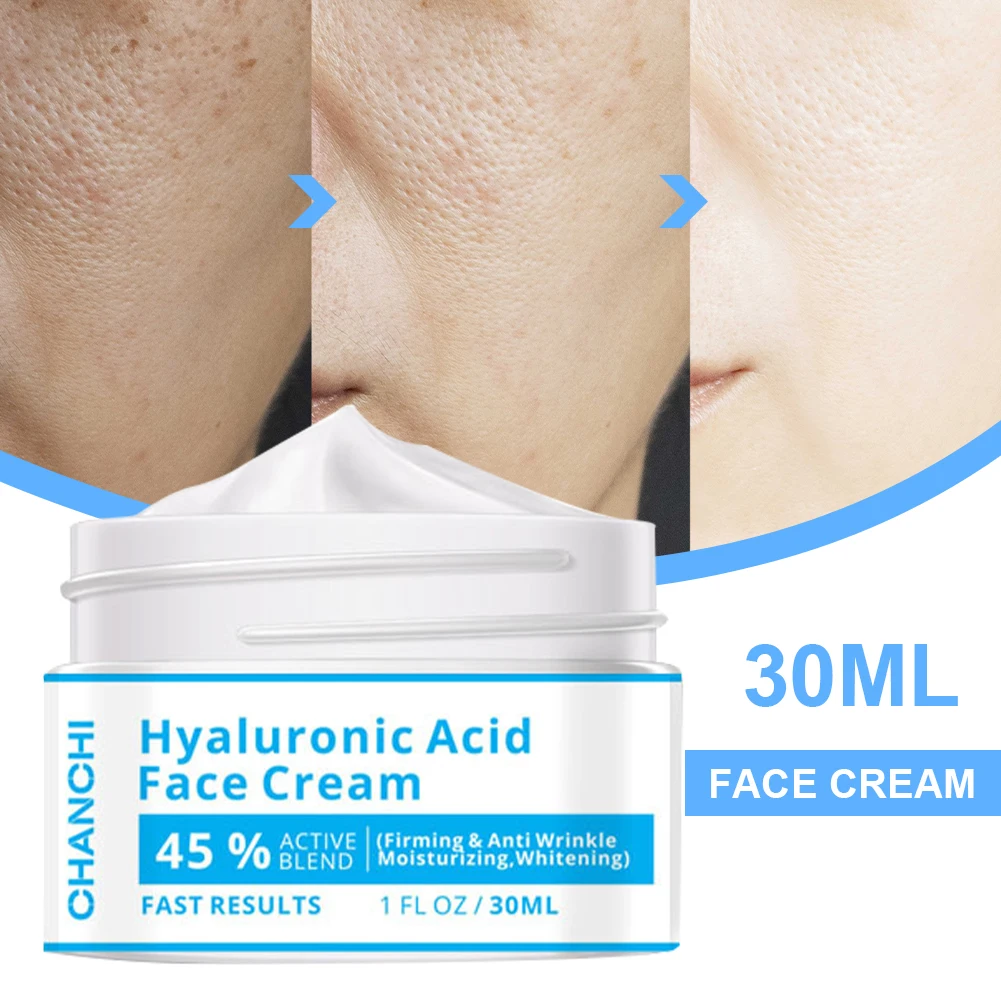 CHANCHI Face Cream Hyaluronic Acid Moisturizing Cream Hamamelis Mollis Shrink Pores Repair Damaged Skin Facial Cream Skin Care
CHANCHI Face Cream Hyaluronic Acid Moisturizing Cream Hamamelis Mollis Shrink Pores Repair Damaged Skin Facial Cream Skin Care