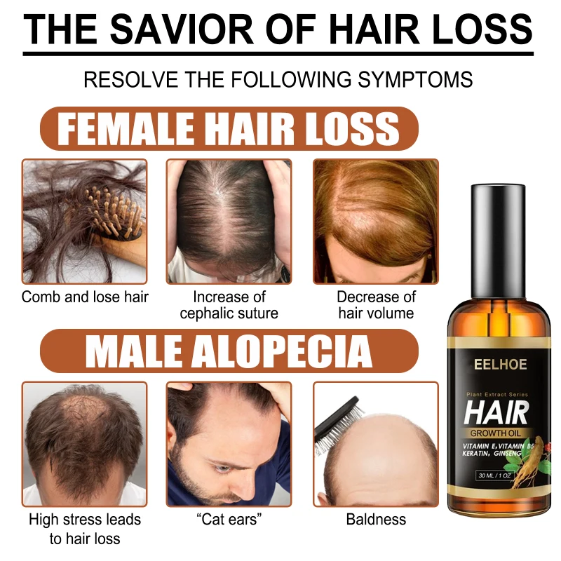 EELHOE 30ml Hair Growth Products Nature Fast Growing Hair Oil Hair Loss Care Spray Beauty Hair & Scalp Growth Serum Unisex TSLM1
EELHOE 30ml Hair Growth Products Nature Fast Growing Hair Oil Hair Loss Care Spray Beauty Hair & Scalp Growth Serum Unisex TSLM1