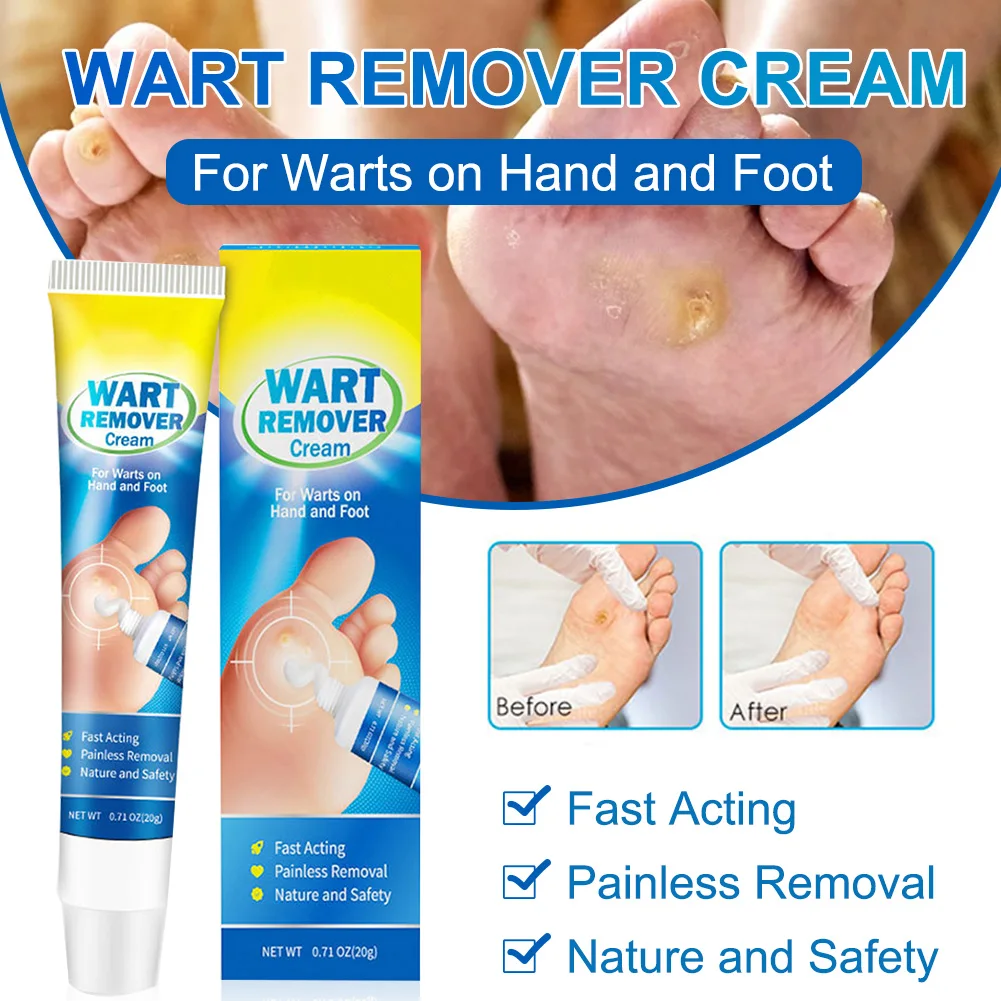 Wart Removal Cream Effective Painless Skin Tag Removal Cream Relieve Pain and Discomfort for Face and Body Wart cream Skin care
Wart Removal Cream Effective Painless Skin Tag Removal Cream Relieve Pain and Discomfort for Face and Body Wart cream Skin care