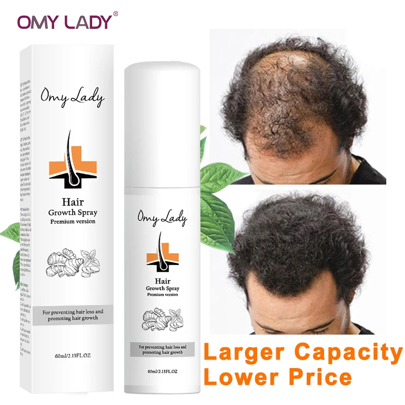 60ML OMYLADY Anti Hair Loss Hair Growth Spray Essential Oil Liquid For Men Women Dry Hair Regeneration Repair,Hair Loss Products
60ML OMYLADY Anti Hair Loss Hair Growth Spray Essential Oil Liquid For Men Women Dry Hair Regeneration Repair,Hair Loss Products