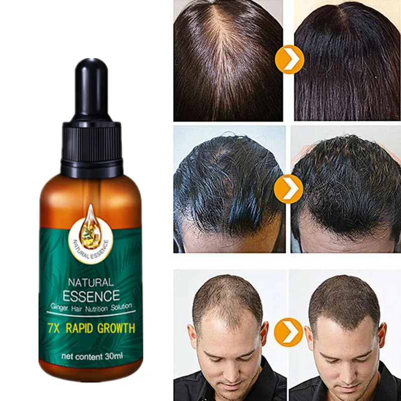 30ml Ginger Hair Growth Nutrient Solution Hair Loss Treatment Hair Protection Essential Oil for Men Women 
30ml Ginger Hair Growth Nutrient Solution Hair Loss Treatment Hair Protection Essential Oil for Men Women