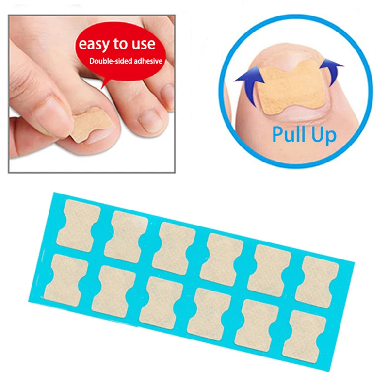 36pcs/pack Professional Embedded Toe Nail Corrector Foot Care Toenail Patch Ingrown Toenail Correction Stickers Pedicure Tool
36pcs/pack Professional Embedded Toe Nail Corrector Foot Care Toenail Patch Ingrown Toenail Correction Stickers Pedicure Tool