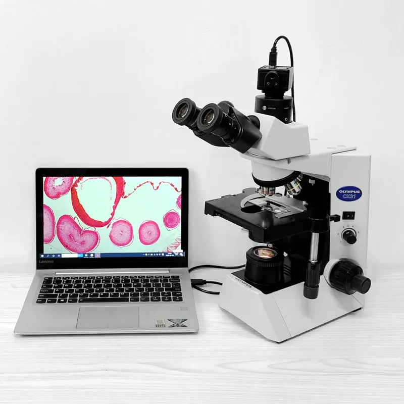 5MP CMOS USB Microscope Camera Digital Electronic Eyepiece Free Driver HD Industrial Camera for Microscope Binocular Trinocular
5MP CMOS USB Microscope Camera Digital Electronic Eyepiece Free Driver HD Industrial Camera for Microscope Binocular Trinocular